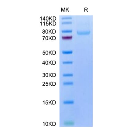 Tris-Bis PAGE - Recombinant Human LRRC15 Protein (C-terminal His and Avi Tag) (A331024) - Antibodies.com