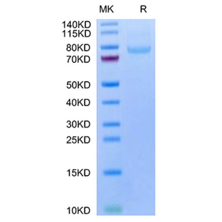 Tris-Bis PAGE - Recombinant Human LRRC15 Protein (C-terminal His and Avi Tag) (A331024) - Antibodies.com