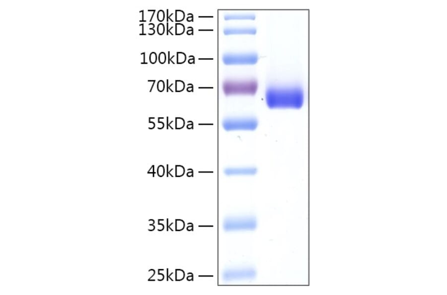 SDS-PAGE - Recombinant Human LTA4H Protein (C-terminal His Tag) (A331025) - Antibodies.com