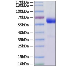 SDS-PAGE - Recombinant Human LTBR Protein (C-terminal Human Fc and His Tag) (A331026) - Antibodies.com