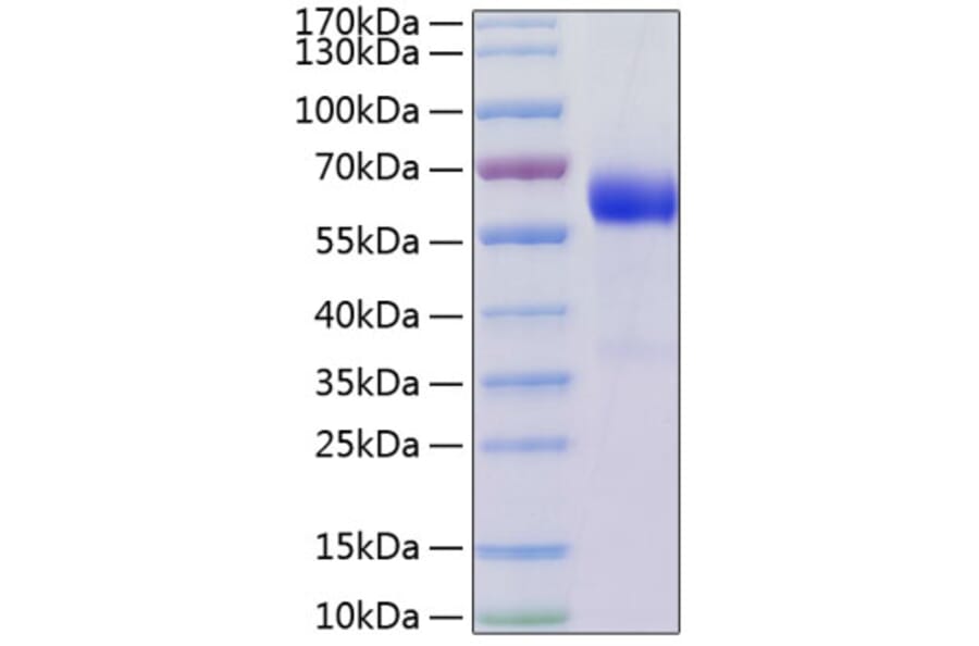 SDS-PAGE - Recombinant Human LTBR Protein (C-terminal Human Fc and His Tag) (A331026) - Antibodies.com