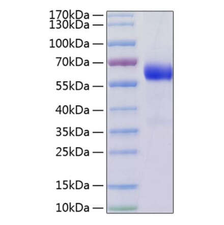 SDS-PAGE - Recombinant Human LTBR Protein (C-terminal Human Fc and His Tag) (A331026) - Antibodies.com