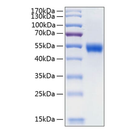 SDS-PAGE - Recombinant Human Lumican Protein (C-terminal His Tag) (A331027) - Antibodies.com