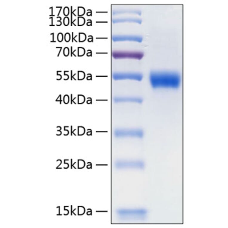 SDS-PAGE - Recombinant Human Lumican Protein (C-terminal His Tag) (A331027) - Antibodies.com