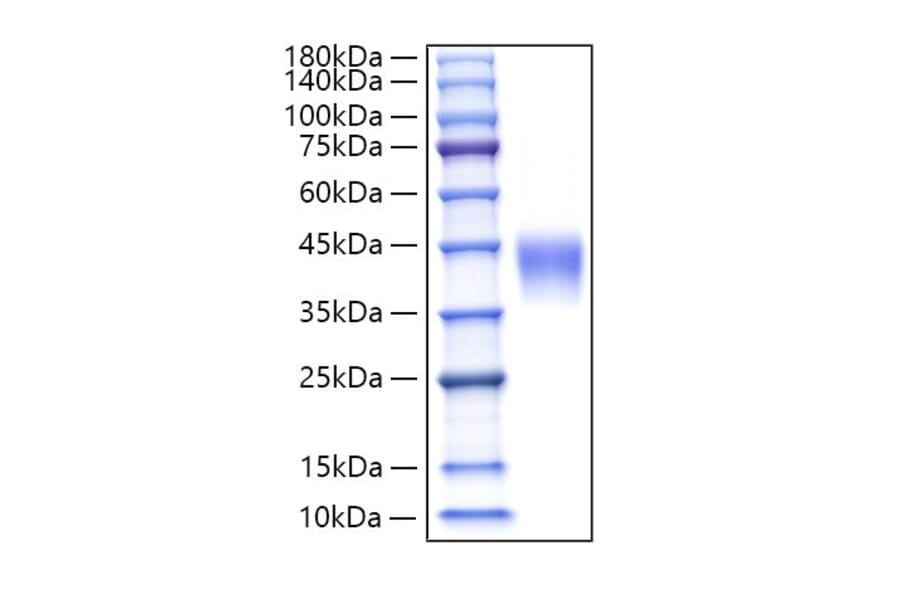 SDS-PAGE - Recombinant Human Luteinizing Hormone beta Protein (C-terminal His Tag) (A331028) - Antibodies.com