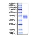 SDS-PAGE - Recombinant Human Luteinizing Hormone beta Protein (C-terminal His Tag) (A331028) - Antibodies.com