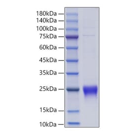 SDS-PAGE - Recombinant Human Lymphotactin Protein (C-terminal His Tag) (A331029) - Antibodies.com