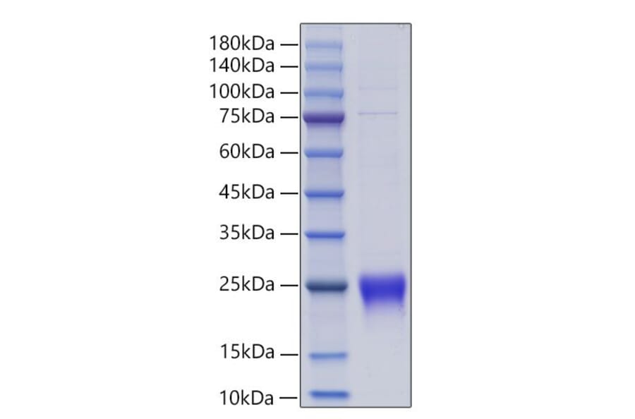 SDS-PAGE - Recombinant Human Lymphotactin Protein (C-terminal His Tag) (A331029) - Antibodies.com
