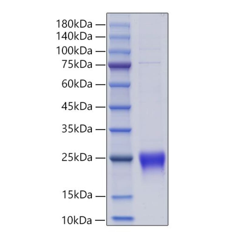 SDS-PAGE - Recombinant Human Lymphotactin Protein (C-terminal His Tag) (A331029) - Antibodies.com