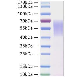SDS-PAGE - Recombinant Human LYPD3 Protein (C-terminal His Tag) (A331030) - Antibodies.com
