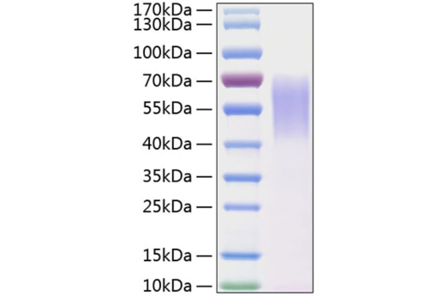 SDS-PAGE - Recombinant Human LYPD3 Protein (C-terminal His Tag) (A331030) - Antibodies.com