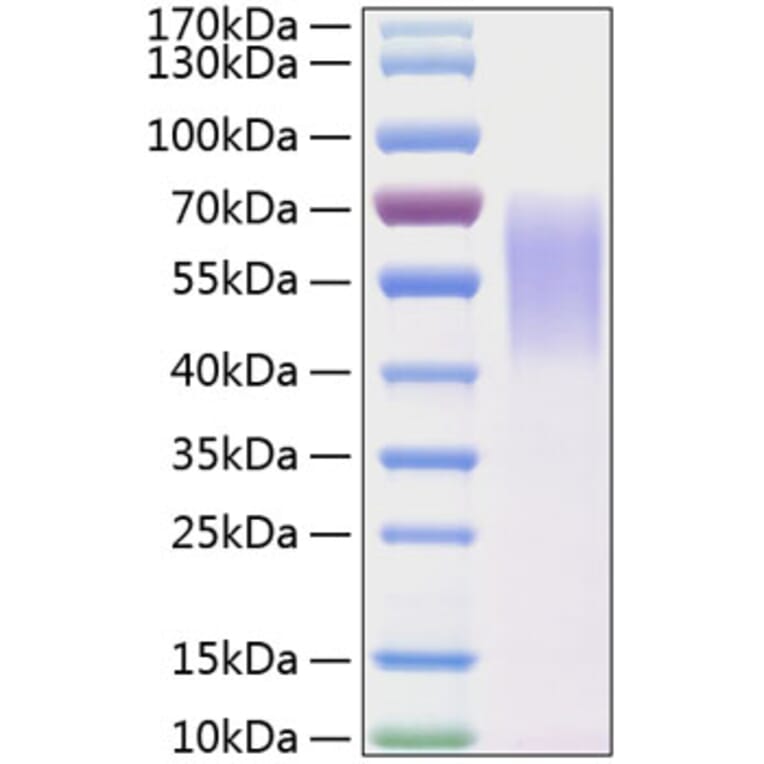 SDS-PAGE - Recombinant Human LYPD3 Protein (C-terminal His Tag) (A331030) - Antibodies.com