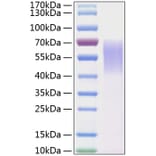 SDS-PAGE - Recombinant Human LYPD3 Protein (C-terminal His Tag) (A331030) - Antibodies.com