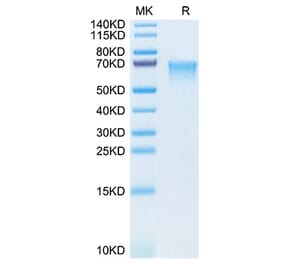 SDS-PAGE - Recombinant Human MAdCAM1 Protein (C-terminal His Tag) (A331031) - Antibodies.com