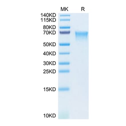 SDS-PAGE - Recombinant Human MAdCAM1 Protein (C-terminal His Tag) (A331031) - Antibodies.com