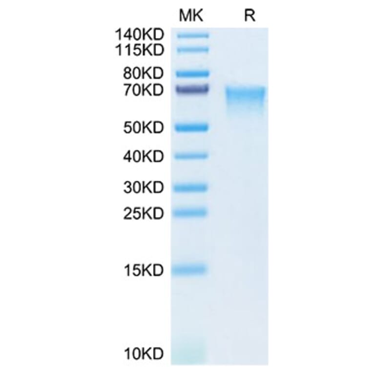 SDS-PAGE - Recombinant Human MAdCAM1 Protein (C-terminal His Tag) (A331031) - Antibodies.com