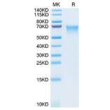 SDS-PAGE - Recombinant Human MAdCAM1 Protein (C-terminal His Tag) (A331031) - Antibodies.com