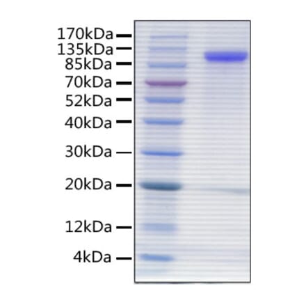 SDS-PAGE - Recombinant Human MAG Protein (C-terminal His Tag) (A331032) - Antibodies.com