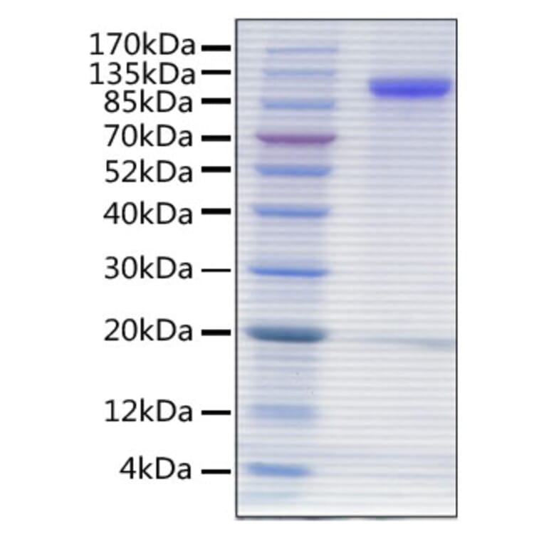 SDS-PAGE - Recombinant Human MAG Protein (C-terminal His Tag) (A331032) - Antibodies.com