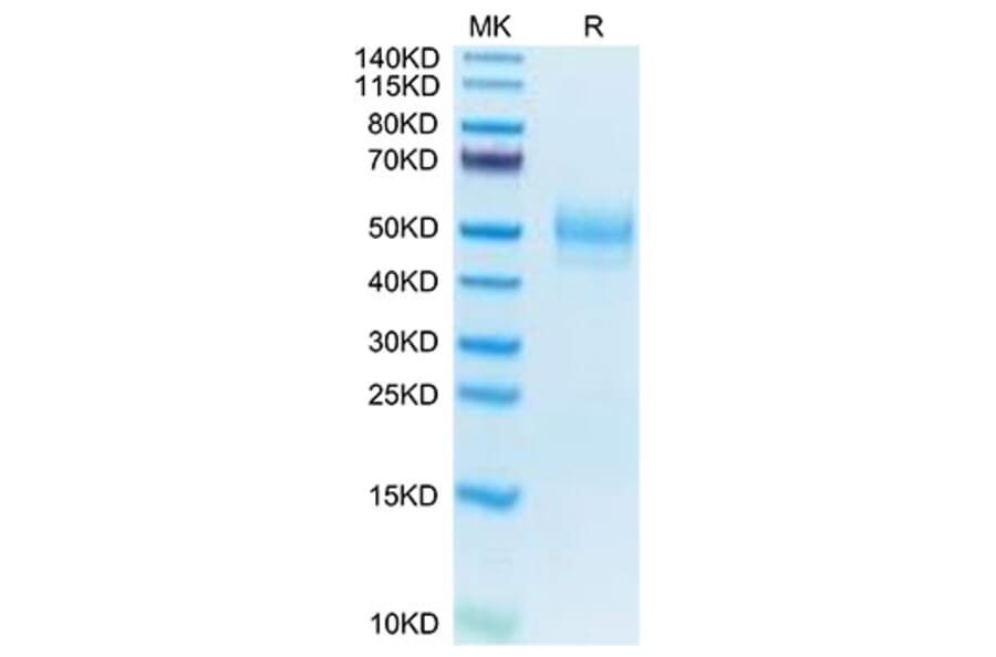 Tris-Bis PAGE - Recombinant Mouse MARCO Protein (N-terminal His Tag) (A331033) - Antibodies.com