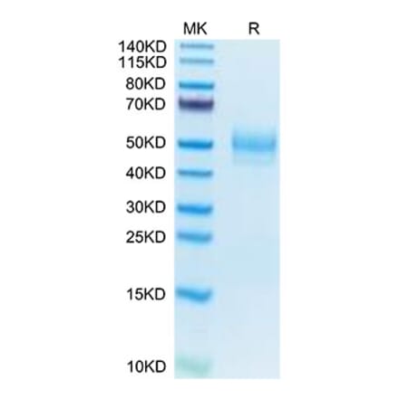 Tris-Bis PAGE - Recombinant Mouse MARCO Protein (N-terminal His Tag) (A331033) - Antibodies.com