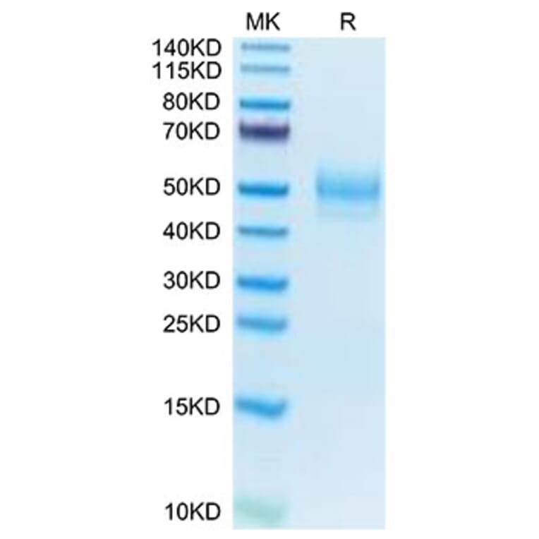 Tris-Bis PAGE - Recombinant Mouse MARCO Protein (N-terminal His Tag) (A331033) - Antibodies.com
