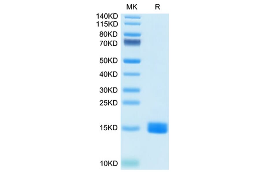 Tris-Bis PAGE - Recombinant Human MARCO Protein (N-terminal His Tag) (A331034) - Antibodies.com