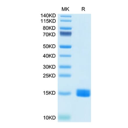 Tris-Bis PAGE - Recombinant Human MARCO Protein (N-terminal His Tag) (A331034) - Antibodies.com