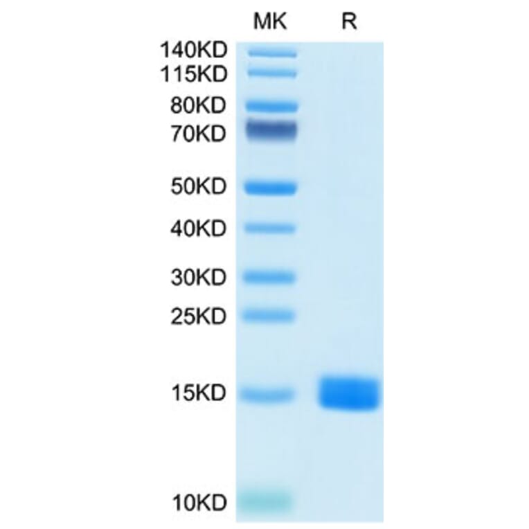 Tris-Bis PAGE - Recombinant Human MARCO Protein (N-terminal His Tag) (A331034) - Antibodies.com