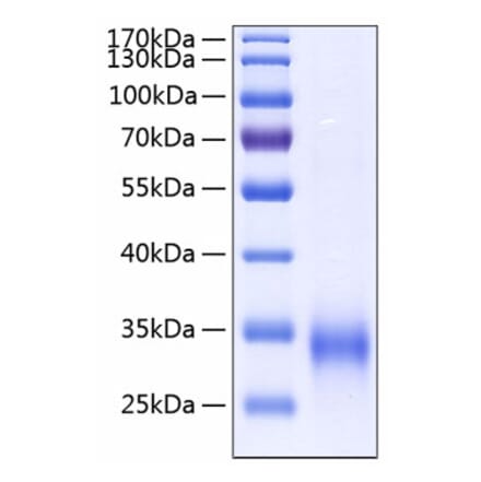 SDS-PAGE - Recombinant Human MBL Protein (C-terminal His Tag) (A331035) - Antibodies.com