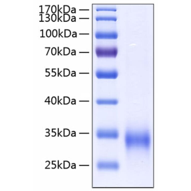 SDS-PAGE - Recombinant Human MBL Protein (C-terminal His Tag) (A331035) - Antibodies.com