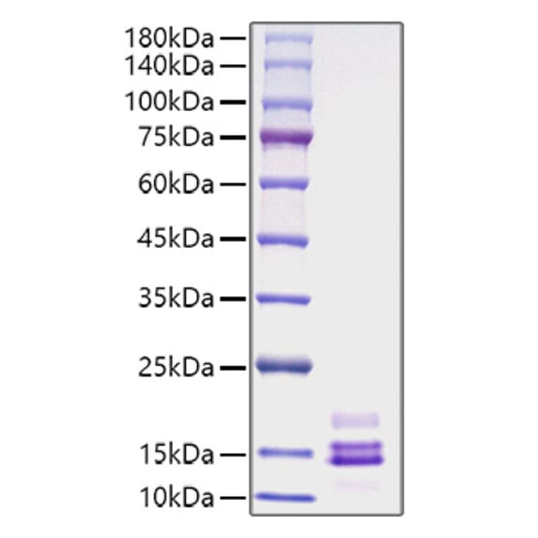 SDS-PAGE - Recombinant Human MCP1 Protein (A331037) - Antibodies.com