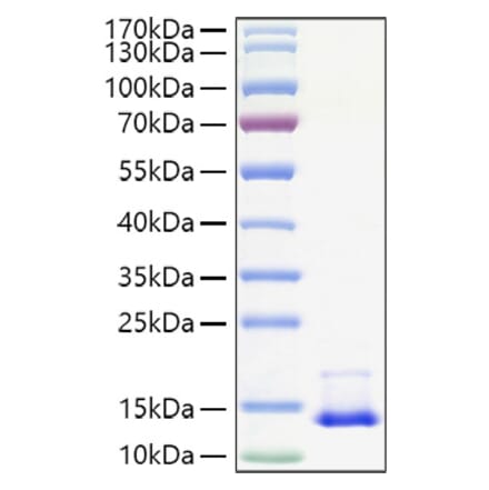 SDS-PAGE - Recombinant Human MCP1 Protein (A331038) - Antibodies.com