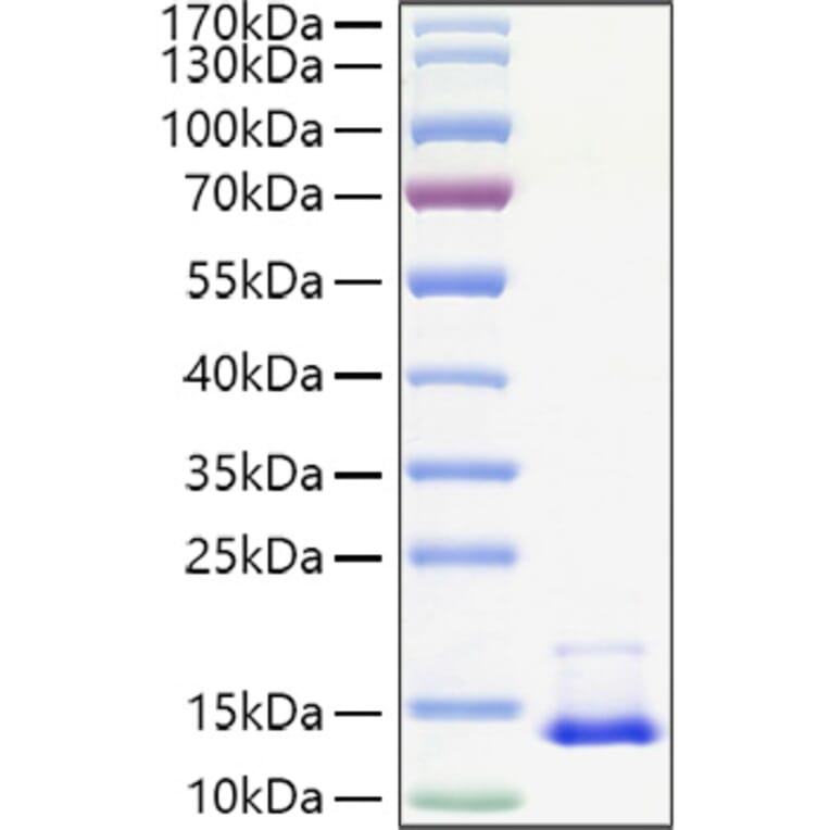 SDS-PAGE - Recombinant Human MCP1 Protein (A331038) - Antibodies.com