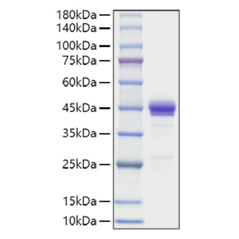 SDS-PAGE - Recombinant Human MCP1 Protein (C-terminal Human Fc Tag) (A331039) - Antibodies.com
