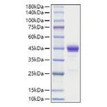 SDS-PAGE - Recombinant Human MCP1 Protein (C-terminal Human Fc Tag) (A331039) - Antibodies.com