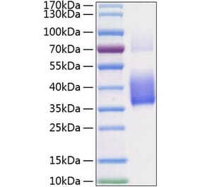 SDS-PAGE - Recombinant Human M-CSF Protein (C-terminal His Tag) (A331043) - Antibodies.com