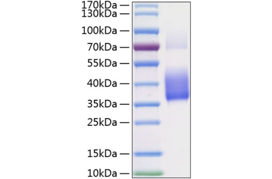 SDS-PAGE - Recombinant Human M-CSF Protein (C-terminal His Tag) (A331043) - Antibodies.com