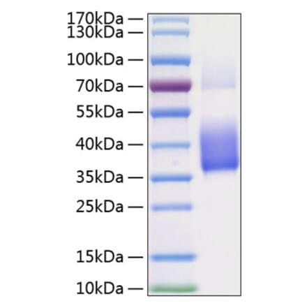 SDS-PAGE - Recombinant Human M-CSF Protein (C-terminal His Tag) (A331043) - Antibodies.com