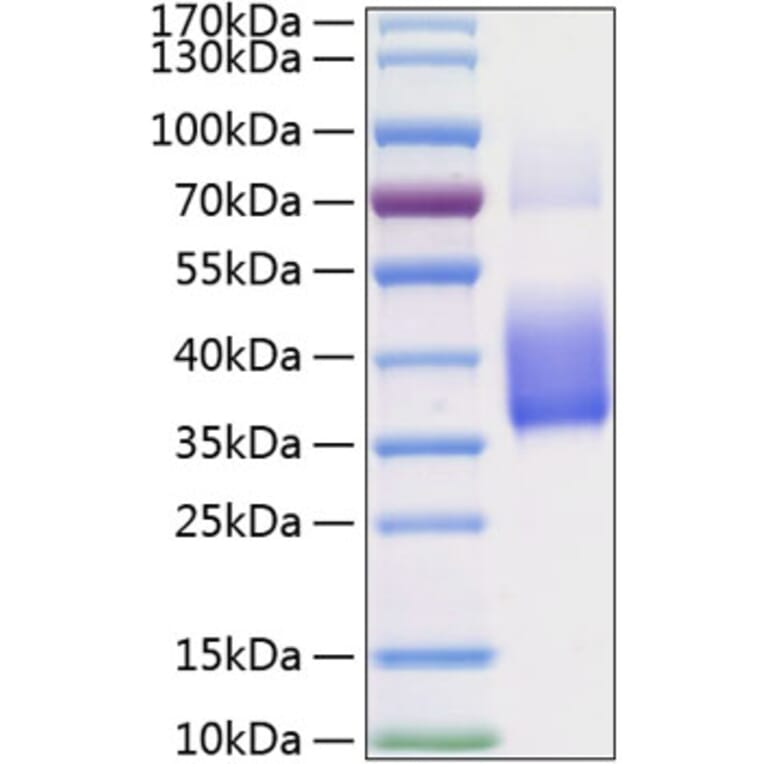 SDS-PAGE - Recombinant Human M-CSF Protein (C-terminal His Tag) (A331043) - Antibodies.com