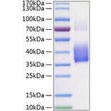 SDS-PAGE - Recombinant Human M-CSF Protein (C-terminal His Tag) (A331043) - Antibodies.com