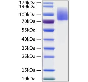 SDS-PAGE - Recombinant Human MERTK Protein (C-terminal His Tag) (A331044) - Antibodies.com