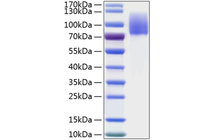SDS-PAGE - Recombinant Human MERTK Protein (C-terminal His Tag) (A331044) - Antibodies.com