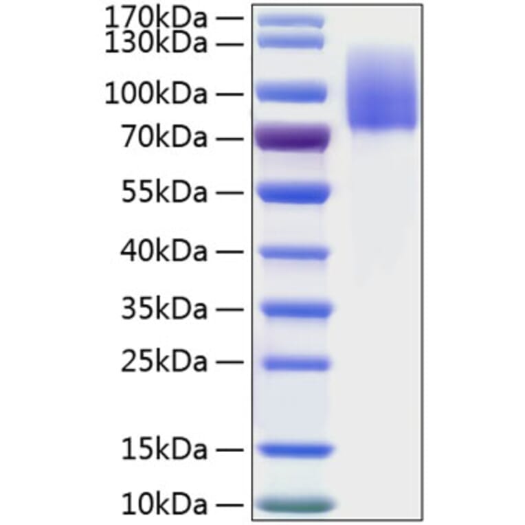 SDS-PAGE - Recombinant Human MERTK Protein (C-terminal His Tag) (A331044) - Antibodies.com