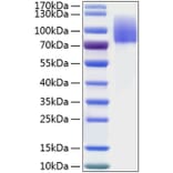 SDS-PAGE - Recombinant Human MERTK Protein (C-terminal His Tag) (A331044) - Antibodies.com