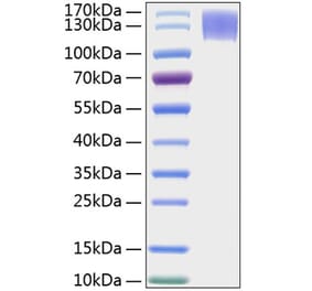 SDS-PAGE - Recombinant Human MERTK Protein (C-terminal Human Fc and His Tag) (A331045) - Antibodies.com