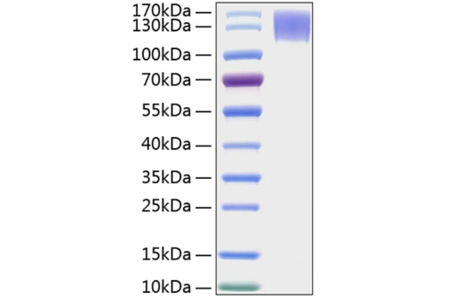 SDS-PAGE - Recombinant Human MERTK Protein (C-terminal Human Fc and His Tag) (A331045) - Antibodies.com