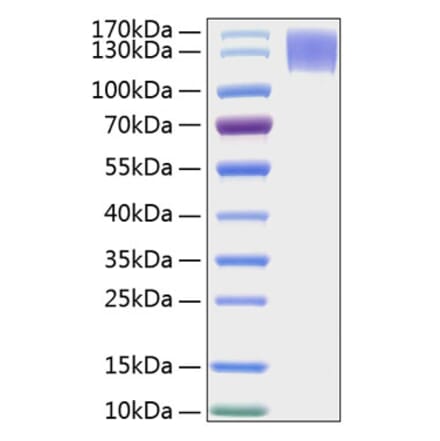 SDS-PAGE - Recombinant Human MERTK Protein (C-terminal Human Fc and His Tag) (A331045) - Antibodies.com