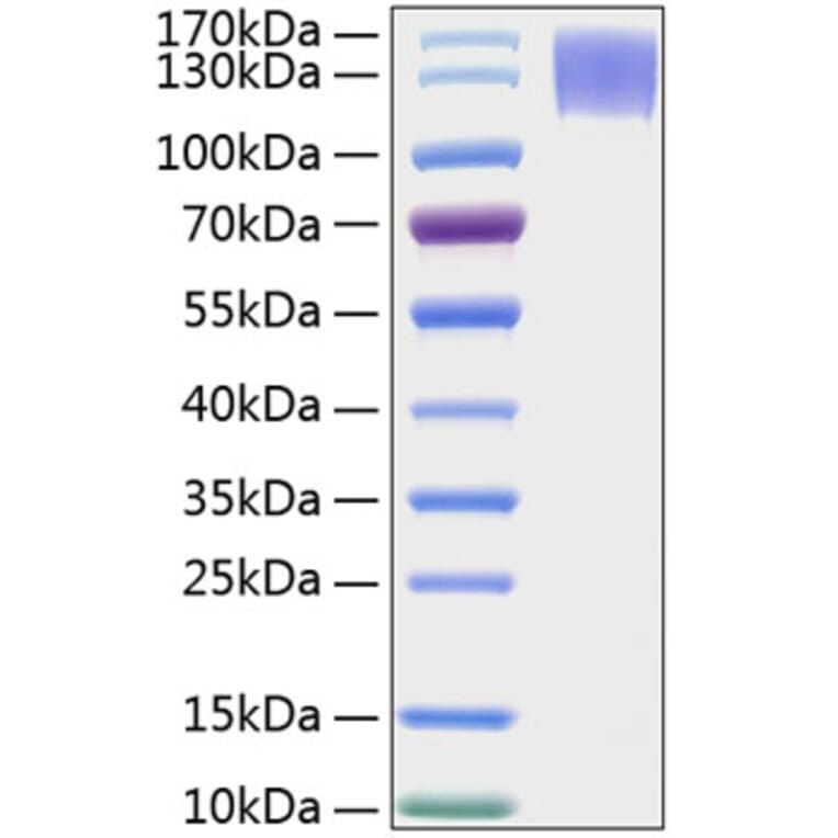 SDS-PAGE - Recombinant Human MERTK Protein (C-terminal Human Fc and His Tag) (A331045) - Antibodies.com