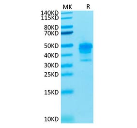 Tris-Bis PAGE - Recombinant Cynomolgus macaque Mesothelin Protein (C-terminal His Tag) (A331046) - Antibodies.com